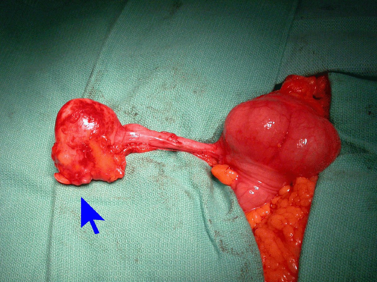 appendix
