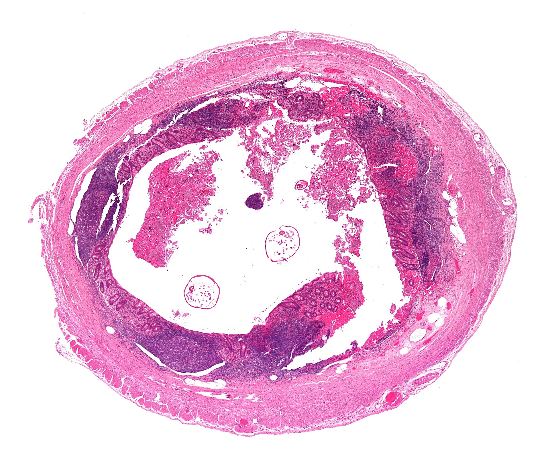appendix