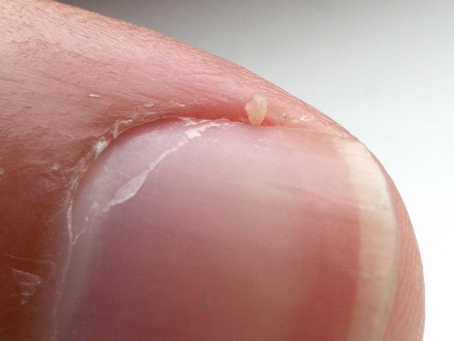 nail growth rate