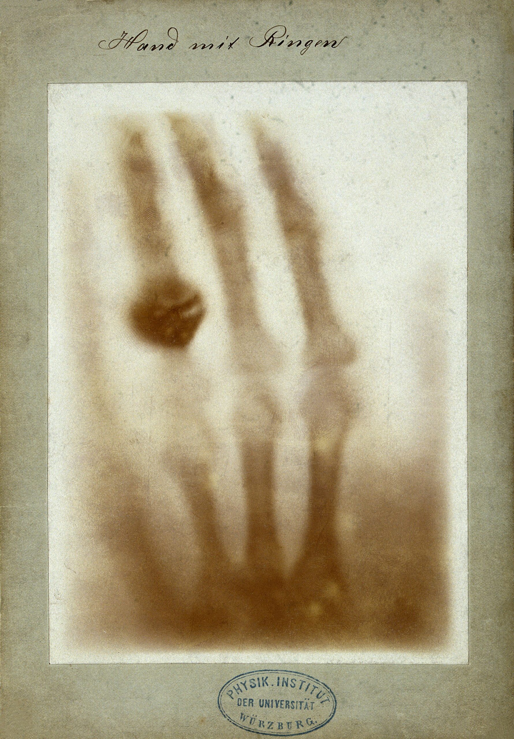 X-rays